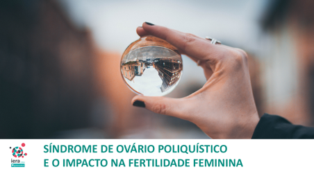Síndrome de Ovário Poliquístico e o impacto na Fertilidade Feminina